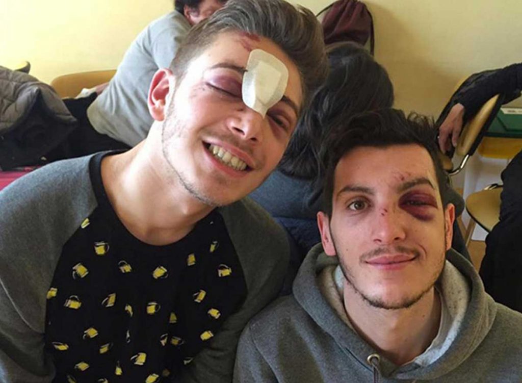 Milan deux garçons de 19 ans tabassés en sortant d'une soirée gay