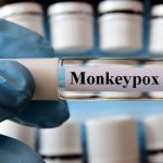 La variole du singe, ou "monkeypox" en anglais